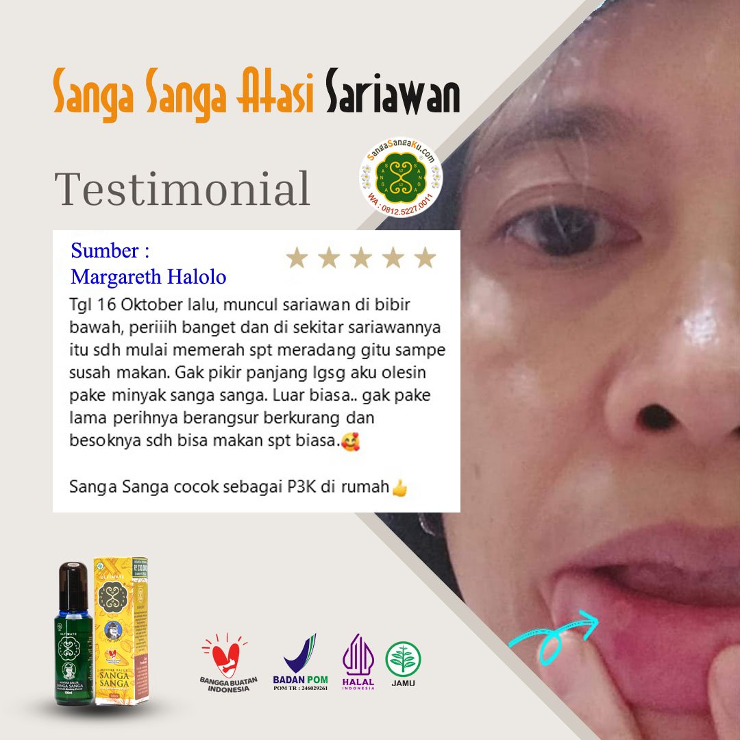 Testimonin Minyak Sanga Sanga - Sariawan